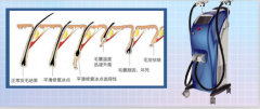廣州脫毛儀器價格，脫毛一次多少錢，用什么儀器比較好？