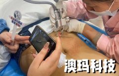 菲蜜麗儀器?私密保養最好儀器_點陣激光儀器排行榜