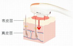 ?牛奶光機(jī)器多少錢一臺？?牛奶光價格報價_?牛奶光設(shè)備多少錢