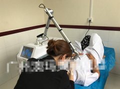 皮秒祛斑項目合作哪家口碑比較好？澳瑪祛斑項目合作_祛斑解決方案