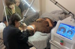 皮秒激光儀器哪個品牌的好？國產超皮秒品牌_皮秒設備哪個品牌最好