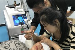 皮秒洗紋身機器哪家好？洗紋身最好的設備是哪種？皮秒洗紋身儀器